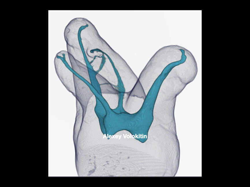 Fig. 4 (Image: Alexey Volokitin)