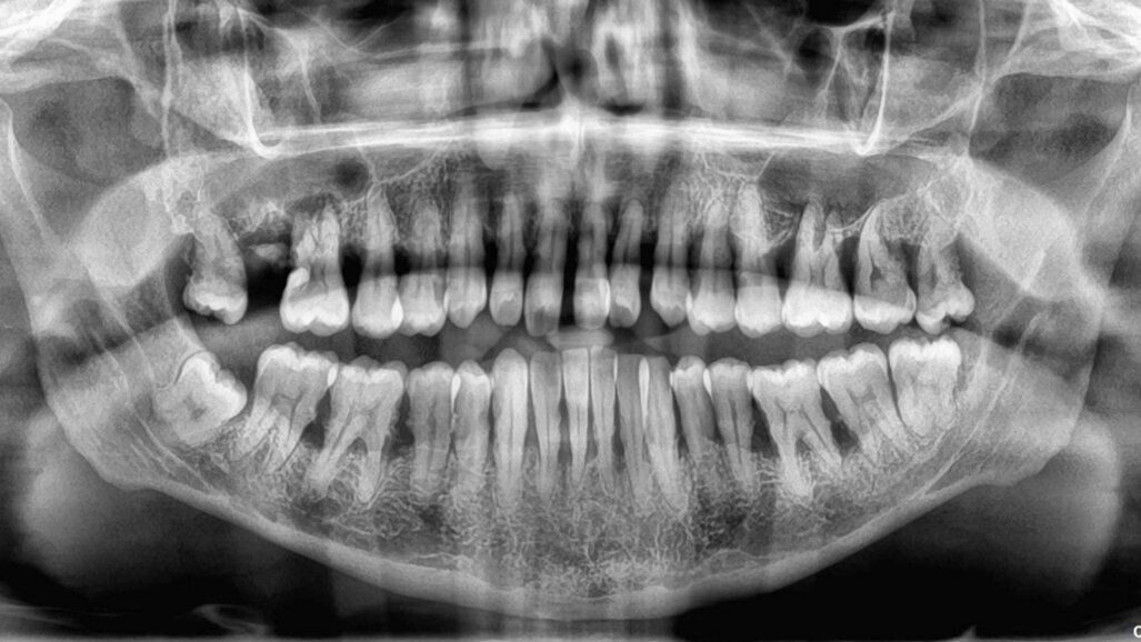 Do our patients know the value of a tooth?