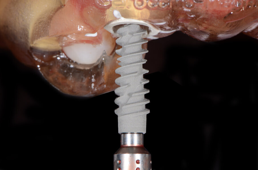 Fig. 29 - Posizionamento impianto 2.2.