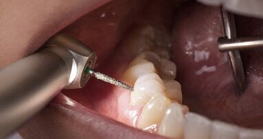 Alegra turbines: The decisive plus in performance