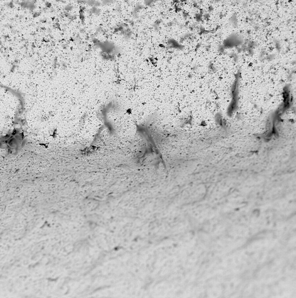 Fig. 7: Significant plastic material (polyacetal) on the shoulder of a ceramic implant (vitaclinical, VITA Zahnfabrik) from abrasion from the packaging.