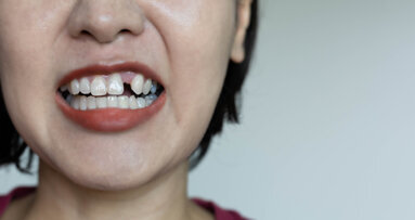 Kidney function is associated with tooth loss in postmenopausal women