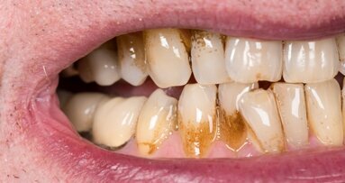 Cariogenic bacteria produce substance that aids calcium tolerance