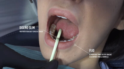 DirectaDentalGroup – Orsing Dental – Hygoformic Bio – How to Use