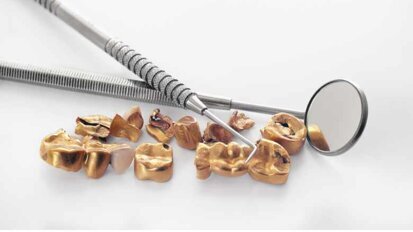 SSO und Rotes Kreuz sammeln wieder Zahngold SSO und Rotes Kreuz sammeln wieder Zahngold