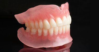 3D-printed dentures put to the test on efficiency and patient outcomes