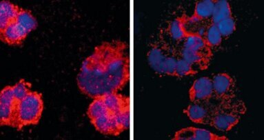 Bakterien können analgetisch wirken