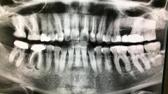 Diagnostic tips for bone lesions with DTX Studio Clinic