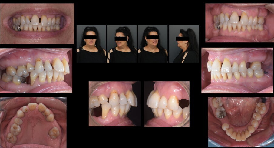 Figg. 1, 2_Situazione iniziale.