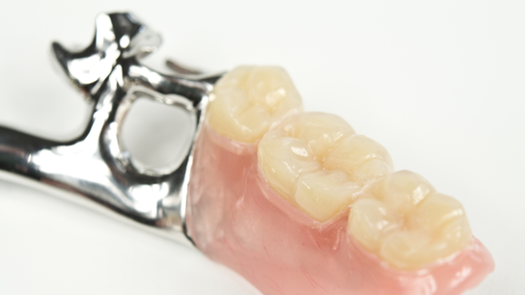 Zweierlei Maß bei ZE-Zuschüssen