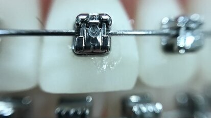 Diagnostyka rezonansem magnetycznym u pacjentów ortodontycznych