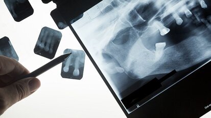 Nascholingsplicht voor tandarts die röntgenopnamen maakt