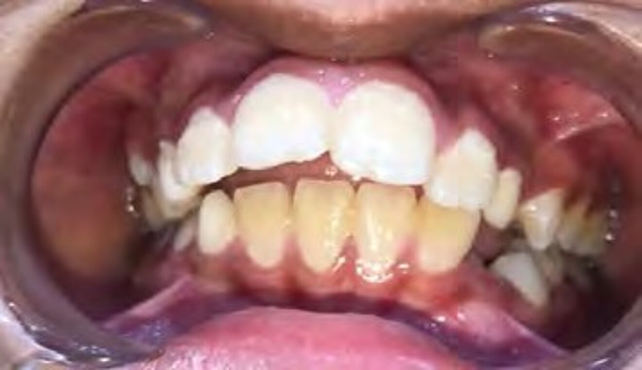 1e