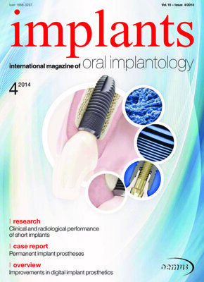 implants international No. 4, 2014 implants international No. 4, 2014