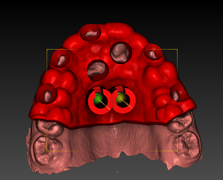 Fig. 5a: Planning in DDS-Pro... 