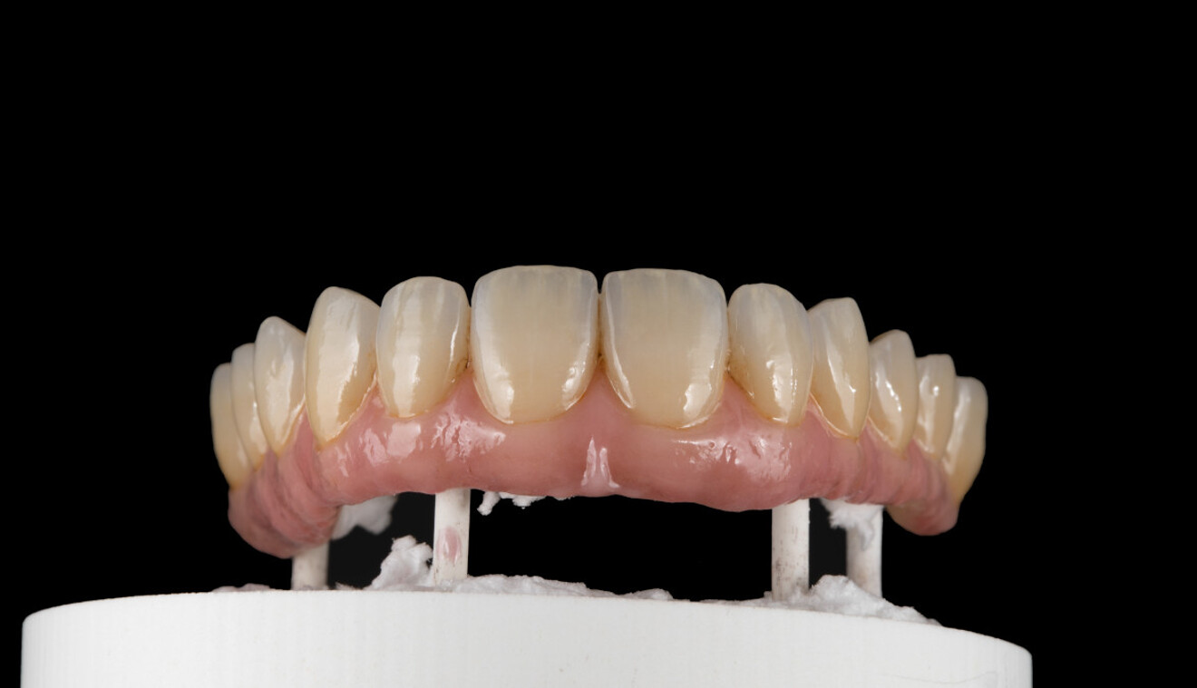 Fig. 12a: Result after glazing, shown from frontal view.