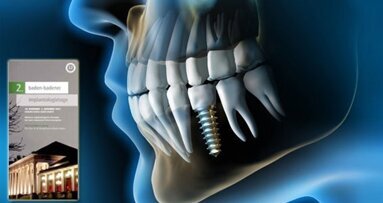 Konzepte bei stark reduziertem Knochenangebot