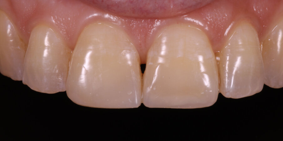 Fig 15. Post op image