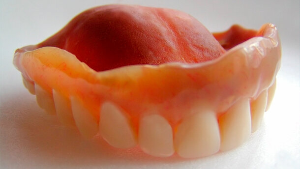 Migliano (Aio Roma): spregevole promuovere le dentiere a metà prezzo per politica e non aiutare le fasce deboli nella prevenzione