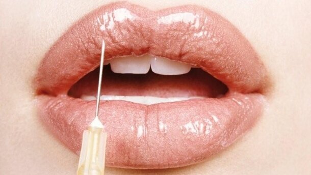 Workshop zur Faltenunterspritzung