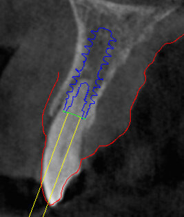 Fig. 12 - Cross impianto 1.2.