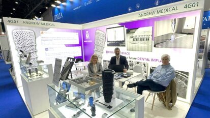 Copying nature with 3D-printed dental implants