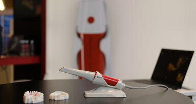 How does Neoss’s NeoScan 1000 compare with other intraoral scanners?