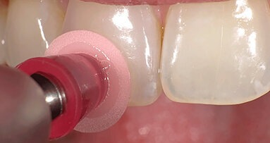 Super-Snap, eficiencia para el pulido y acabado