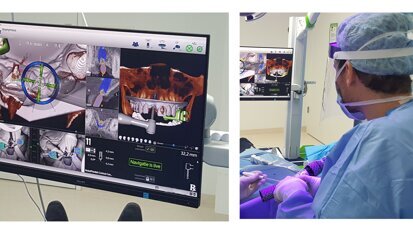 University College of Dentistry workshop demonstrates All-on-4 implants