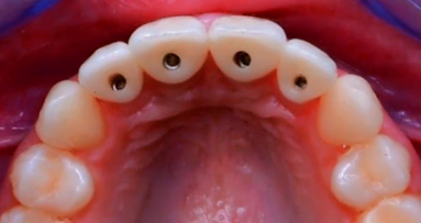 NobelClinician is the key to successful treatment outcomes