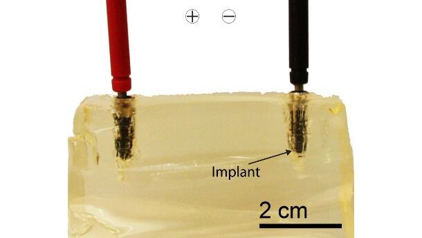 Wissenschaftler setzen Implantate unter Strom