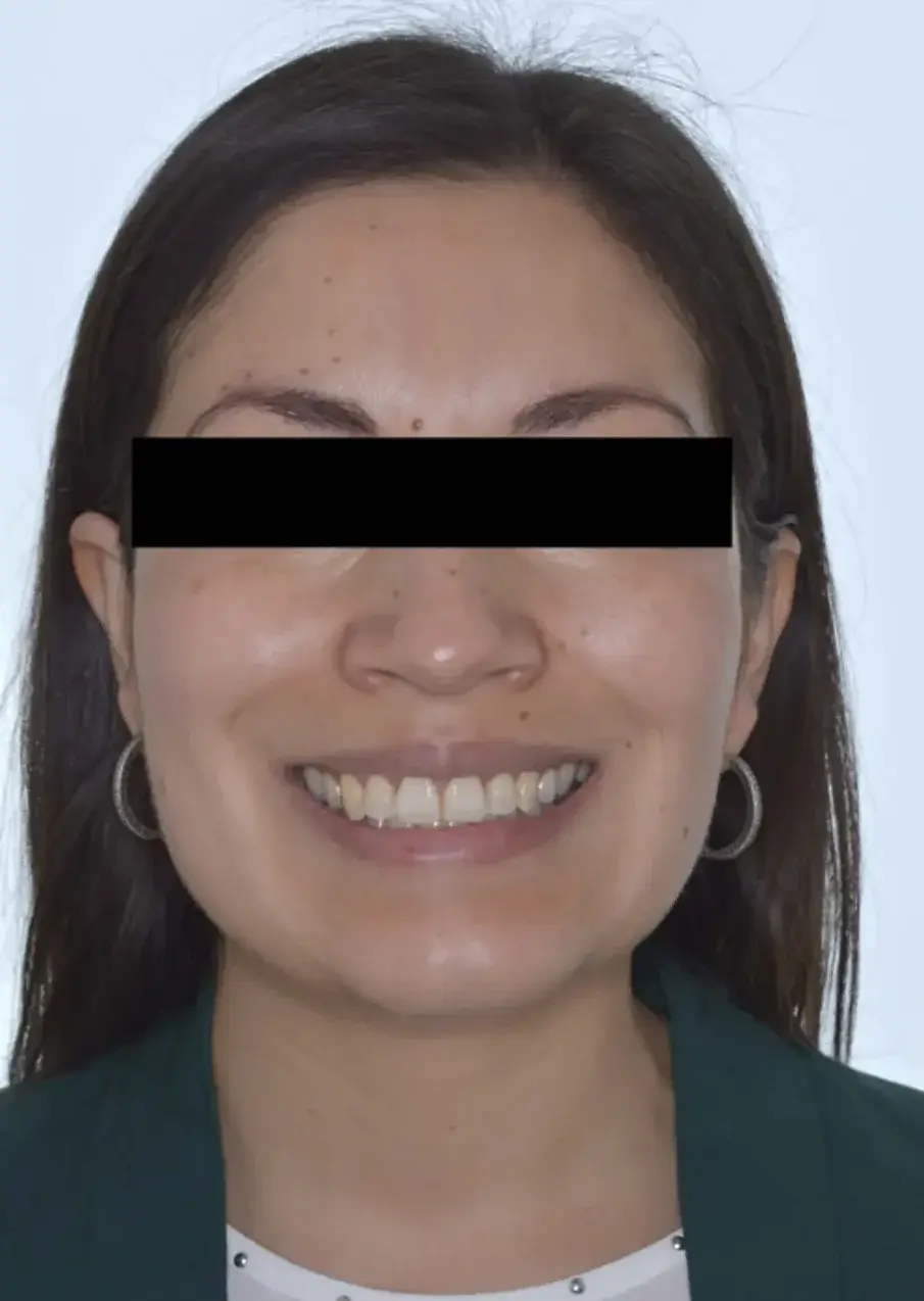 Фиг. 12б: ... и след.