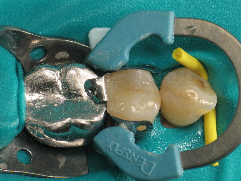 Fig. 13 : Modélisation des sillons.