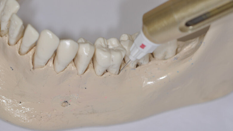 Drei Fragen zu schmerzfreier Zahnmedizin