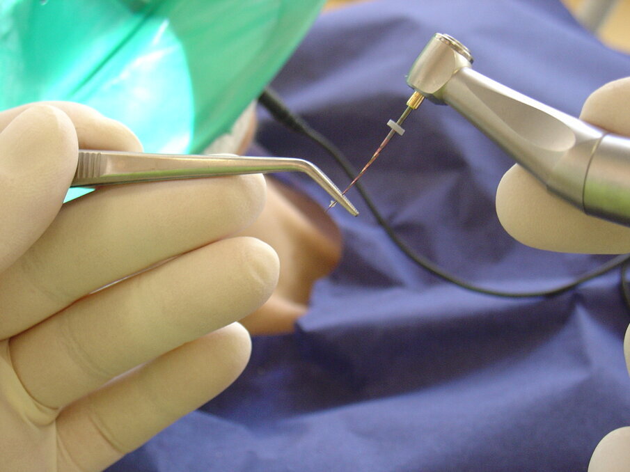 Fig. 3: Pre-bendable NiTi file.