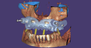 Nuevo exoplan 3.0 Galway ahora disponible