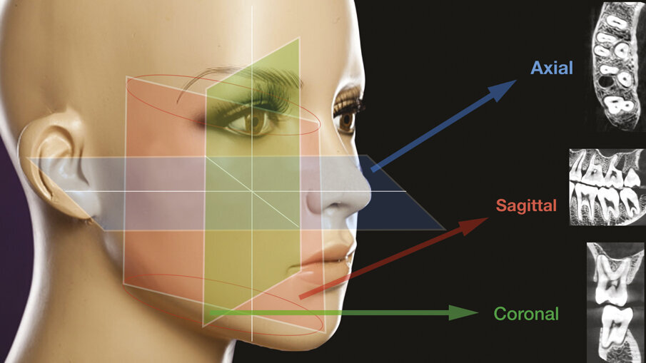 Figg. 4a-4c - - La CBCT offre la possibilità di fornire e immagazzinare immagini radiografiche leggibili su vari piani sia orizzontali che verticali: assiale, sagittale e coronale.