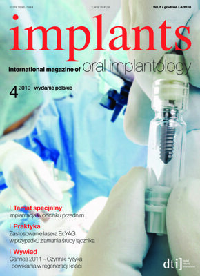 implants Poland No. 4, 2010 implants Poland No. 4, 2010
