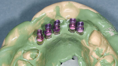 Opětovné implantologické ošetření