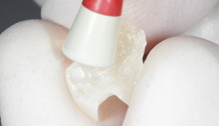 Fig. 5: Extraoral polishing with OptraPol