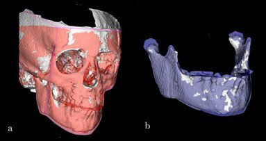 L’ortodonzia digitale…  a portata di click