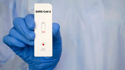 TestV: So dürfen Zahnärzte testen TestV: So dürfen Zahnärzte testen