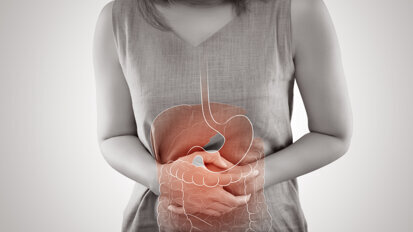 Large-scale study links periodontitis and inflammatory bowel disease