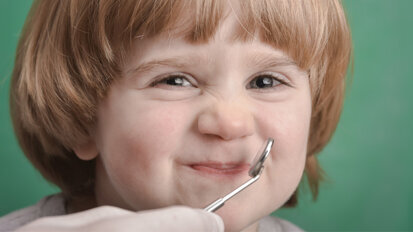 Hefepilz: Blockade könnte frühkindliche Karies verhindern Hefepilz: Blockade könnte frühkindliche Karies verhindern