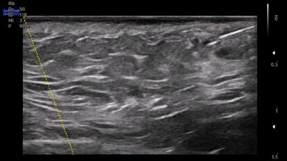 Qualità e sicurezza in medicina estetica del volto: il ruolo  dell’ecografia ambulatoriale
