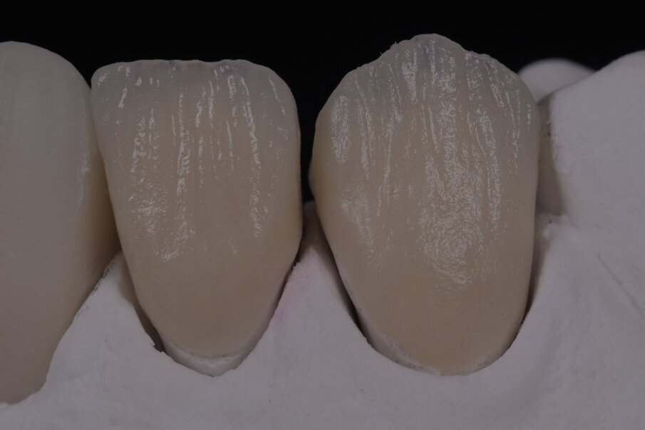 Fig. 28: Internal texture.