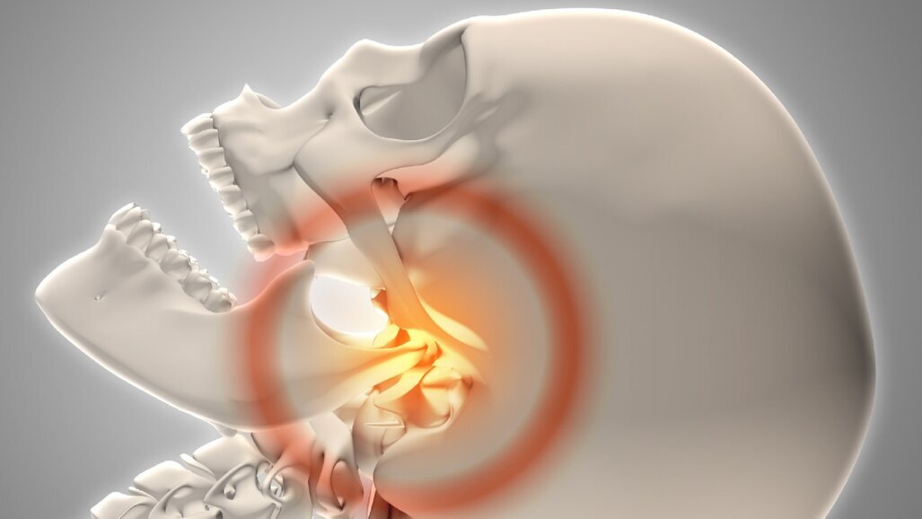 Trwają prace nad trwalszym implantem stawu skroniowo-żuchwowego
