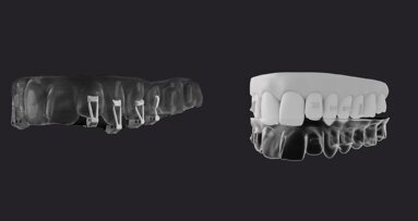 The power of precision—Clarity Precision Grip Attachments