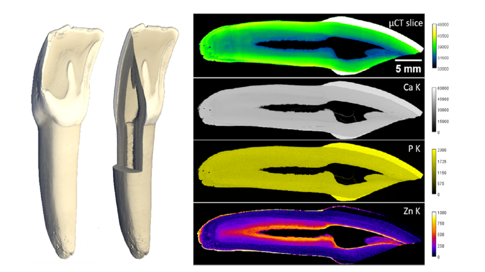 Left: Micro-computer tomography of a complete tooth; the cross-section next to it shows internal structures. Top right: Micro-CT section of the same volume shows absorption. Below are intensity distributions of fluorescence measurements of phosphorus, calcium and zinc. While the main components calcium and phosphorus are distributed homogeneously, the zinc concentration increases towards the pulp. (Image: Helmholtz-Zentrum Berlin)