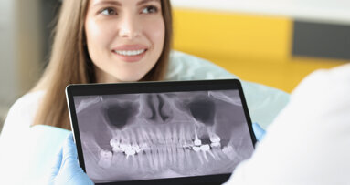 Le chaînon manquant